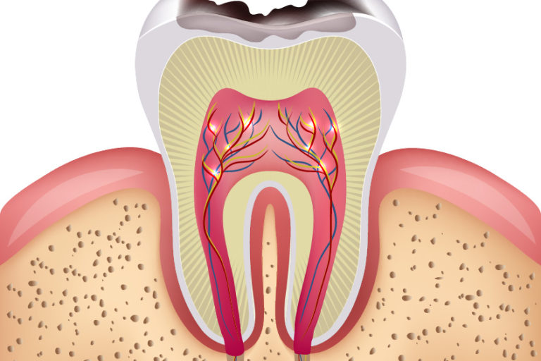 Produits Dentaires Article IrriFlex