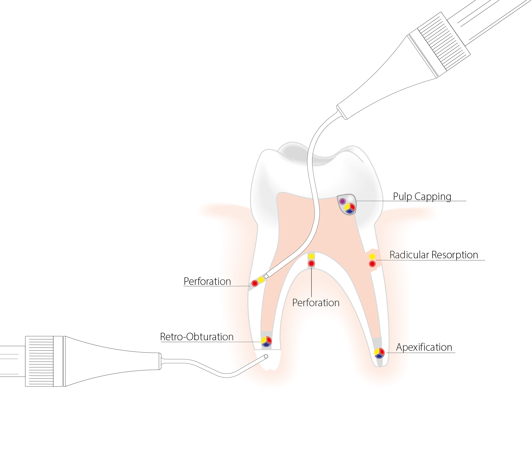 Dent_NiTi+Surgery_needles_EN_210812