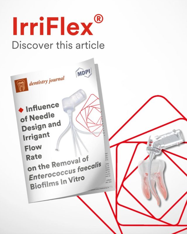 🔬 Revisit a key study on biofilm removal in endodontics featuring Irriflex! 🦷
The article "Influence of Needle Design and Irrigant Flow Rate on Biofilm Removal of Enterococcus faecalis" explores how these two factors impact clinical outcomes.
💡 Don't miss the results about our Irriflex irrigation needle.
📖 Link of the full study in bio
#Endodontics #BiofilmRemoval #DentalResearch #Irriflex #IrrigationNeedle #ClinicalStudy