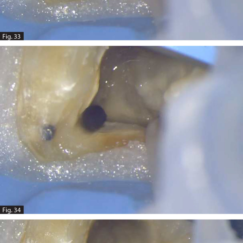 Klinische Aspekte der Endo-Desinfektion von PD Dental Produkte
